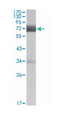 CER1, Mouse, Clone: 9D6, Abnova 100&mu;L; Unlabeled:Antibodies, Monoclonal