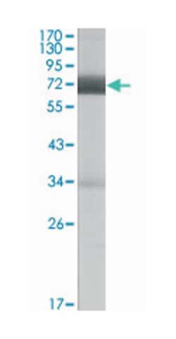 CER1, Mouse, Clone: 5C6, Abnova 100&mu;L; Unlabeled:Antibodies, Monoclonal