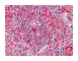 ARNTL, Mouse, Clone: 1C5, Abnova 100 &mu;L | Buy Online | Abnova Corporation | Fisher Scientific