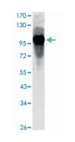 ARNTL, Mouse, Clone: 1C5, Abnova 100 &mu;L | Buy Online | Abnova Corporation | Fisher Scientific