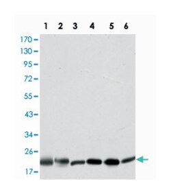 BID, Mouse, Clone: 3C5, Abnova 100&mu;L; Unlabeled:Antibodies, Monoclonal