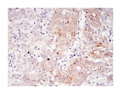 BLNK, Mouse, Clone: 5G9, Abnova 100&mu;L; Unlabeled:Antibodies, Monoclonal