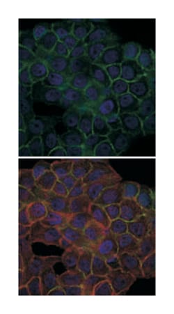 BLNK, Mouse, Clone: 5G9, Abnova 100&mu;L; Unlabeled:Antibodies, Monoclonal