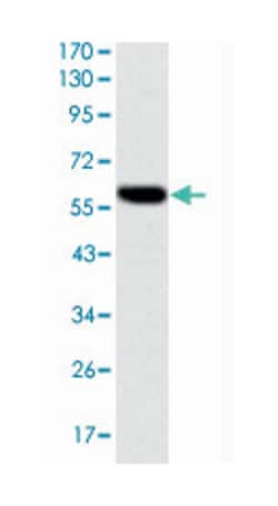 BLNK, Mouse, Clone: 5G9, Abnova 100&mu;L; Unlabeled:Antibodies, Monoclonal