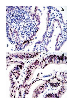 JUN, Mouse, Clone: 5B1, Abnova 100&mu;L; Unlabeled:Antibodies, Monoclonal