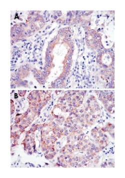 REL, Mouse, Clone: 1E7, Abnova 100&mu;L; Unlabeled:Antibodies, Monoclonal