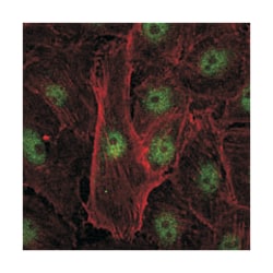 REL, Mouse, Clone: 1E7, Abnova 100&mu;L; Unlabeled:Antibodies, Monoclonal