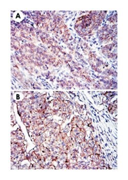 CD9, Mouse, Clone: 5G6, Abnova 100&mu;L; Unlabeled:Antibodies, Monoclonal