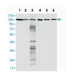 CDH1, Mouse, Clone: 7A2, Abnova 100 &mu;L | Buy Online | Abnova | Fisher Scientific