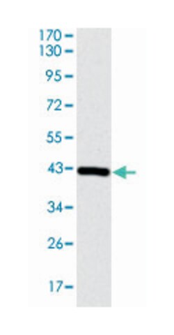 COTL1, Mouse, Clone: 5C8, Abnova 100&mu;L; Unlabeled:Antibodies, Monoclonal