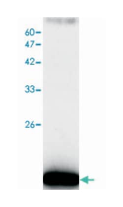 CFL1, Mouse, Clone: 5, Abnova 100&mu;g; Unlabeled:Antibodies, Monoclonal