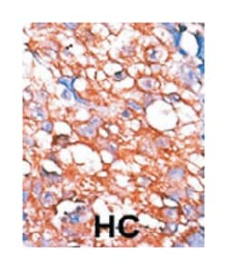 Abnova Corporation ERBB4 (phospho Y1162), Rabbit anti-Human, Polyclonal Antibody, Abnova™