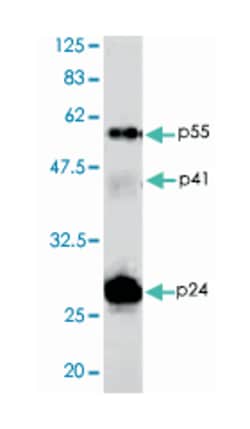 immunodeficiency virus-1 (HIV-1) Gag p24 protein, Guinea pig, Polyclonal Antibody, Abnova 50 &mu;L | Buy Online | Abnova Corporation | Fisher Scientific