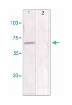 ESR1 (phospho S167), Rabbit anti-Human, Polyclonal Antibody, Abnova 100&mu;g;