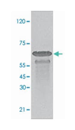 PRKAA1 (phospho S79), Rabbit anti-Human, Polyclonal Antibody, Abnova 100 &mu;g | Buy Online | Abnova Corporation | Fisher Scientific