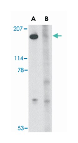 SLITRK5 Rabbit anti-Human, Mouse, Rat, Polyclonal Antibody, Abnova 100&mu;g;