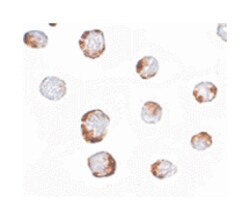 HINT1, Rabbit, Polyclonal Antibody, Abnova 100 &mu;g | Buy Online | Abnova | Fisher Scientific