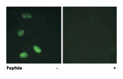 MYB Rabbit anti-Human, Mouse, Polyclonal Antibody, Abnova 100&mu;g; Unlabeled:Antibodies,