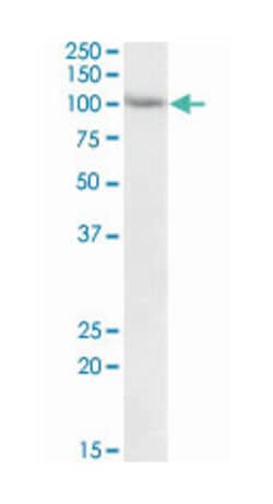 TRIM71 Goat anti-Human, Mouse, Polyclonal Antibody, Abnova 100 &mu;g | Buy Online | Abnova Corporation | Fisher Scientific