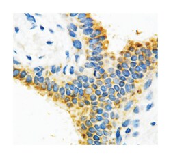 MTA1, Rabbit, Polyclonal Antibody, Abnova 100&mu;g; Unlabeled:Antibodies,