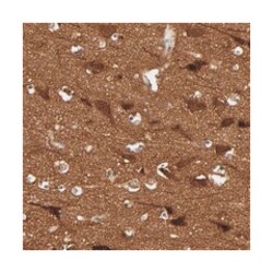 WASF1 Rabbit anti-Human, Polyclonal Antibody, Abnova 100 &mu;L | Buy Online | Abnova | Fisher Scientific
