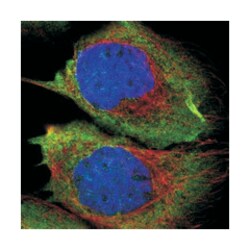 RASGRF2, Rabbit, Polyclonal Antibody, Abnova 100 &mu;L | Buy Online | Abnova Corporation | Fisher Scientific