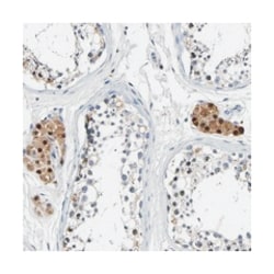 SLCO2B1, Rabbit, Polyclonal Antibody, Abnova 100 &mu;L | Buy Online | Abnova Corporation | Fisher Scientific