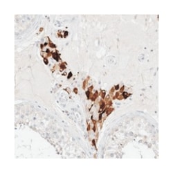 SARM1 Rabbit anti-Human, Polyclonal Antibody, Abnova 100 &mu;L | Buy Online | Abnova Corporation | Fisher Scientific