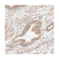 FAM150A, Rabbit, Polyclonal Antibody, Abnova 100 &mu;L | Buy Online | Abnova Corporation | Fisher Scientific