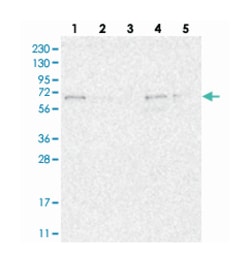 FAM63A, Rabbit, Polyclonal Antibody, Abnova 100 &mu;L | Buy Online | Abnova Corporation | Fisher Scientific