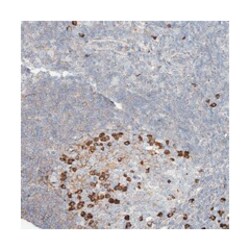 ZFP30, Rabbit, Polyclonal Antibody, Abnova 100&mu;L; Unlabeled:Antibodies,