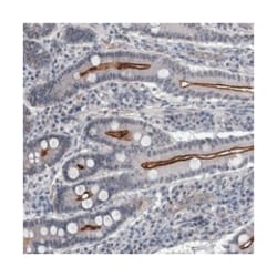 SLC12A8 Rabbit anti-Human, Polyclonal Antibody, Abnova 100 &mu;L | Buy Online | Abnova Corporation | Fisher Scientific