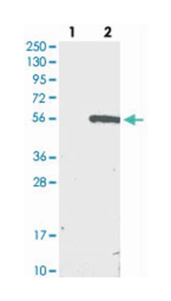 METTL18, Rabbit, Polyclonal Antibody, Abnova 100 &mu;L | Buy Online | Abnova Corporation | Fisher Scientific