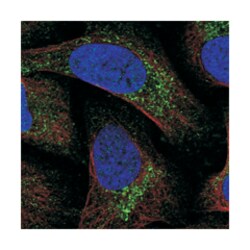 MITD1, Rabbit, Polyclonal Antibody, Abnova 100 &mu;L | Buy Online | Abnova Corporation | Fisher Scientific