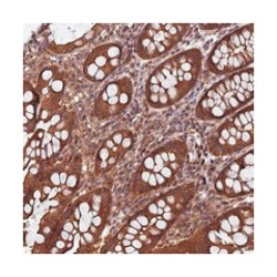 CCDC125, Rabbit, Polyclonal Antibody, Abnova 100 &mu;L | Buy Online | Abnova Corporation | Fisher Scientific