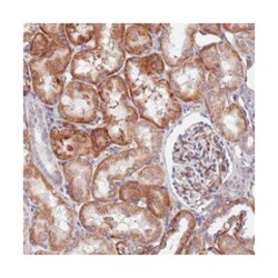 GPR113, Rabbit, Polyclonal Antibody, Abnova 100 &mu;L | Buy Online | Abnova Corporation | Fisher Scientific