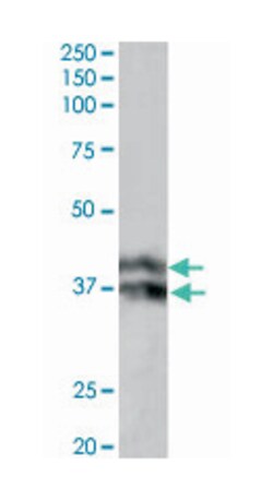HP Goat anti-Human, Polyclonal Antibody, Abnova 100 &mu;g | Buy Online | Abnova Corporation | Fisher Scientific