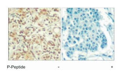 AKT1 (phospho T450), Rabbit anti-Human, Mouse, Rat, Polyclonal Antibody,