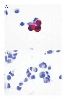 PRLHR Rabbit anti-Bovine, Dog, Horse, Human, Monkey, Pig, Polyclonal Antibody, Abnova 50 &mu;g | Buy Online | Abnova Corporation | Fisher Scientific