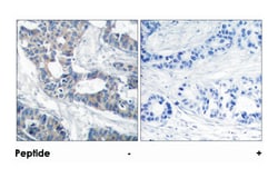 MAP2K1 Rabbit anti-Human, Mouse, Rat, Polyclonal Antibody, Abnova 100&mu;g;
