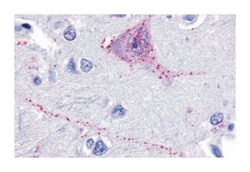 TACR3 Rabbit anti-Human, Polyclonal Antibody, Abnova 50 &mu;g | Buy Online | Abnova Corporation | Fisher Scientific