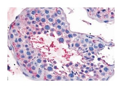 BEST2 Rabbit anti-Dog, Human, Monkey, Polyclonal Antibody, Abnova 50&mu;g;