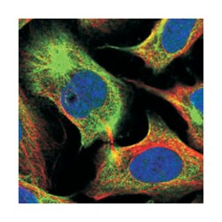 CCDC94, Rabbit, Polyclonal Antibody, Abnova 100 &mu;L | Buy Online | Abnova Corporation | Fisher Scientific