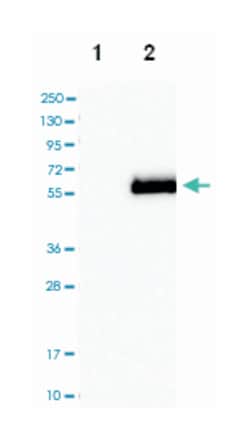 APOH, Rabbit, Polyclonal Antibody, Abnova 100&mu;L; Unlabeled:Antibodies,