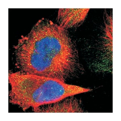 NUP62CL, Rabbit, Polyclonal Antibody, Abnova 100 &mu;L | Buy Online | Abnova Corporation | Fisher Scientific
