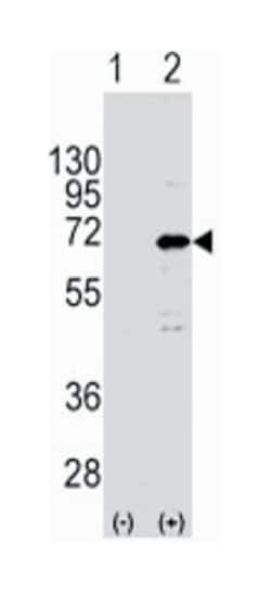 CNOT4 Rabbit anti-Human, Polyclonal Antibody, Abnova 400 &mu;L | Buy Online | Abnova Corporation | Fisher Scientific