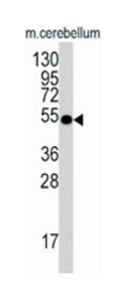 CDC25A Rabbit anti-Human, Polyclonal Antibody, Abnova 400 &mu;L | Buy Online | Abnova Corporation | Fisher Scientific