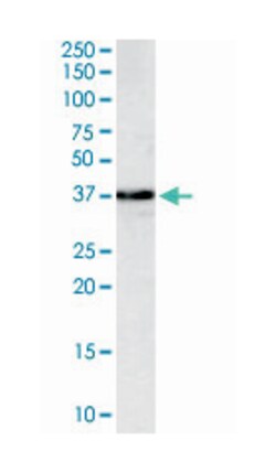 MPG, Goat, Polyclonal Antibody, Abnova 100 &mu;g | Buy Online | Abnova Corporation | Fisher Scientific