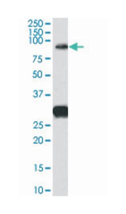 FOXP2 Goat anti-Human, Rat, Polyclonal Antibody, Abnova 100 &mu;g | Buy Online | Abnova Corporation | Fisher Scientific