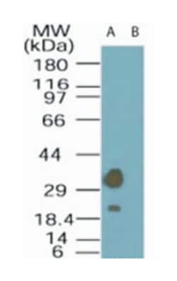 STRADA (LYK5), Rabbit, Polyclonal Antibody, Abnova 100&mu;g; Unlabeled:Antibodies,